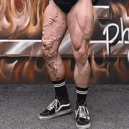 HOT PRODUCT | LOW STOCK Bee Venom Detox Patches(10 Pcs)(Buy 1 Get 1 Free)